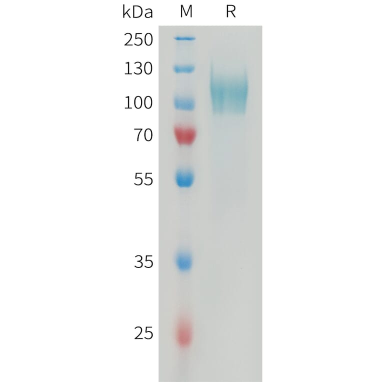 SDS-PAGE - Recombinant Human PDGFR alpha Protein (6xHis Tag) (A325046) - Antibodies.com
