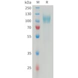 SDS-PAGE - Recombinant Human PDGFR alpha Protein (6xHis Tag) (A325046) - Antibodies.com