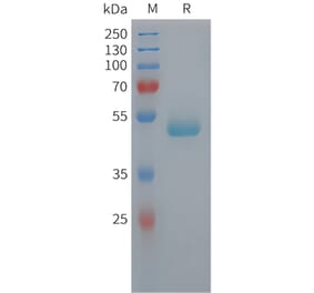 SDS-PAGE - Recombinant Human PEDF Protein (6xHis Tag) (A325047) - Antibodies.com