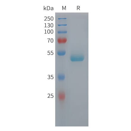 SDS-PAGE - Recombinant Human PEDF Protein (6xHis Tag) (A325047) - Antibodies.com
