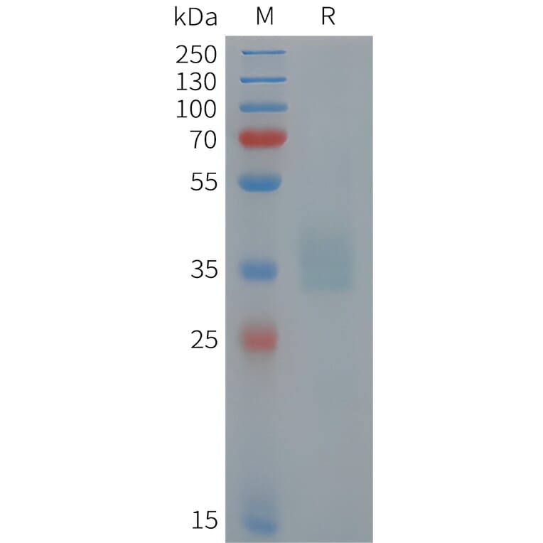 SDS-PAGE - Recombinant Human POMC Protein (6xHis Tag) (A325049) - Antibodies.com