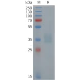 SDS-PAGE - Recombinant Human POMC Protein (6xHis Tag) (A325049) - Antibodies.com