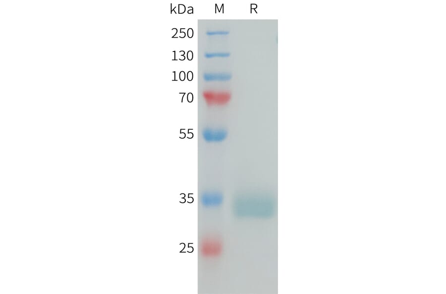 SDS-PAGE - Recombinant Human Prolactin Receptor/PRL-R Protein (10xHis Tag) (A325051) - Antibodies.com