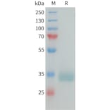 SDS-PAGE - Recombinant Human Prolactin Receptor/PRL-R Protein (10xHis Tag) (A325051) - Antibodies.com