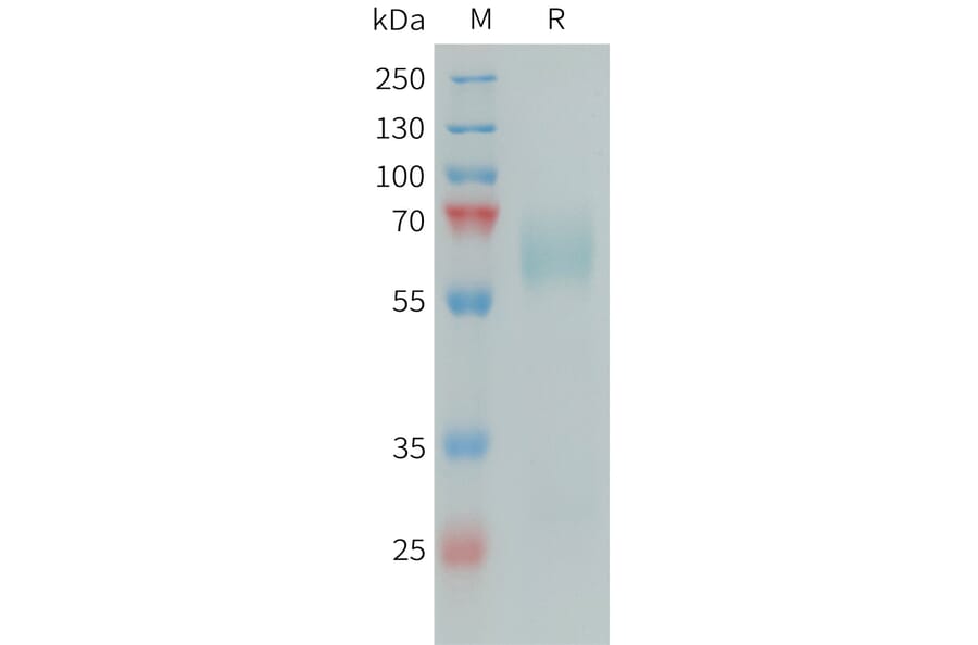 SDS-PAGE - Recombinant Human PSAP Protein (6xHis Tag) (A325053) - Antibodies.com