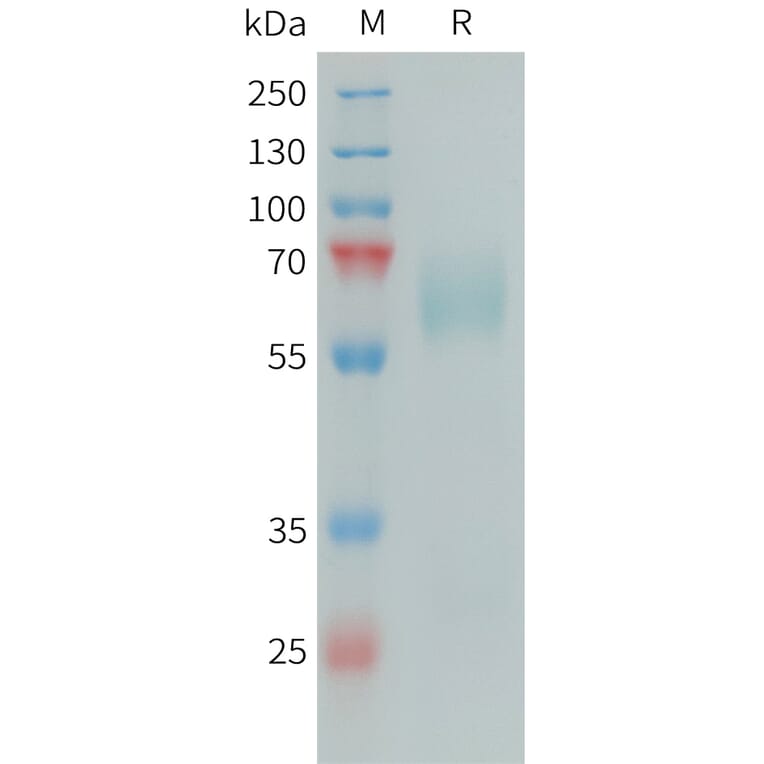 SDS-PAGE - Recombinant Human PSAP Protein (6xHis Tag) (A325053) - Antibodies.com