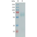 SDS-PAGE - Recombinant Human PSAP Protein (6xHis Tag) (A325053) - Antibodies.com