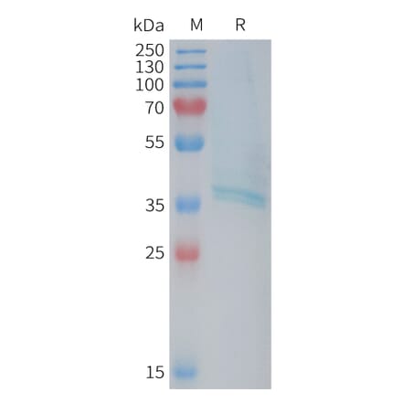 SDS-PAGE - Recombinant Human RAMP1 Protein (Fc Tag) (A325054) - Antibodies.com