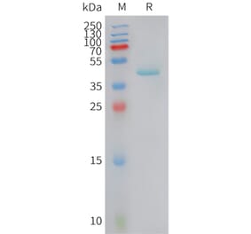 SDS-PAGE - Recombinant Human RANTES Protein (Fc Tag) (A325055) - Antibodies.com
