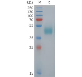 SDS-PAGE - Recombinant Human ROR1 Protein (Fc Tag) (A325056) - Antibodies.com