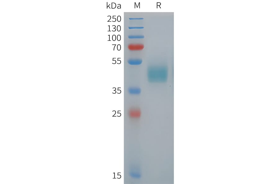 SDS-PAGE - Recombinant Human ROR1 Protein (Fc Tag) (A325056) - Antibodies.com