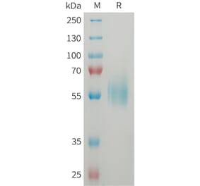 SDS-PAGE - Recombinant Human ST2 Protein (6xHis Tag) (A325057) - Antibodies.com