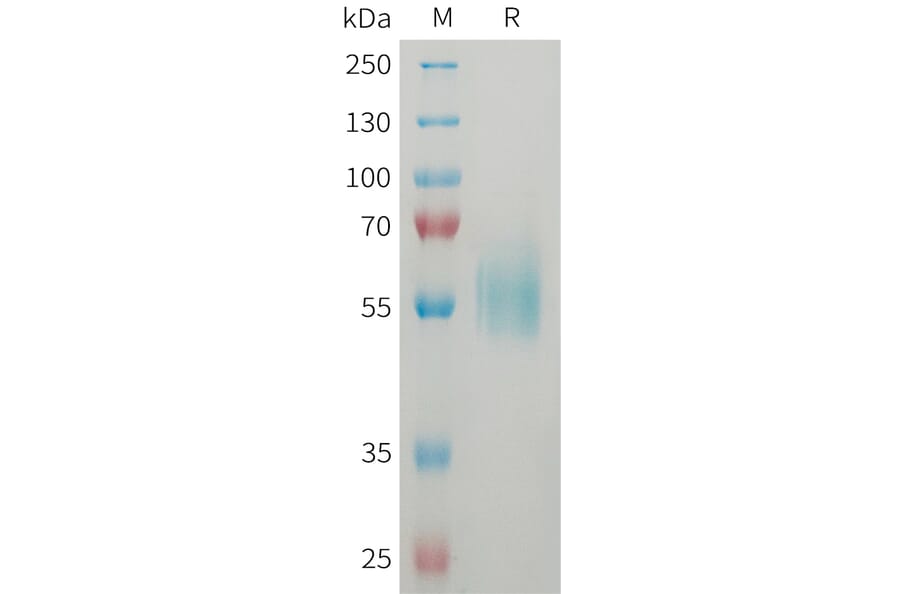 SDS-PAGE - Recombinant Human ST2 Protein (6xHis Tag) (A325057) - Antibodies.com