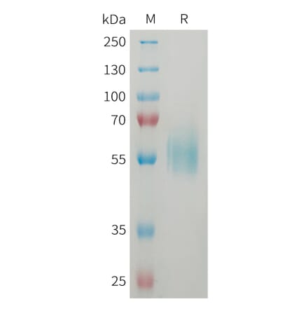 SDS-PAGE - Recombinant Human ST2 Protein (6xHis Tag) (A325057) - Antibodies.com