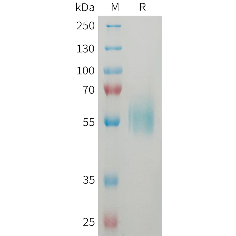 SDS-PAGE - Recombinant Human ST2 Protein (6xHis Tag) (A325057) - Antibodies.com