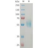 SDS-PAGE - Recombinant Human ST2 Protein (6xHis Tag) (A325057) - Antibodies.com