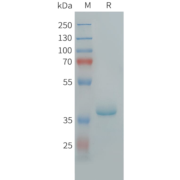 SDS-PAGE - Recombinant Human TARC/CCL17 Protein (Fc Tag) (A325058) - Antibodies.com