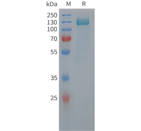 SDS-PAGE - Recombinant Human Tau Protein (6xHis Tag) (A325059) - Antibodies.com