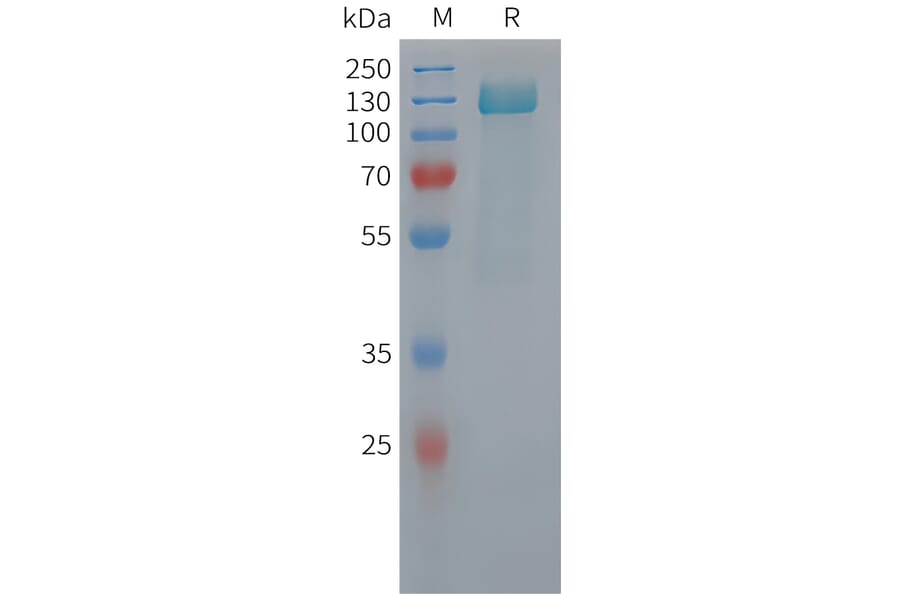 SDS-PAGE - Recombinant Human Tau Protein (6xHis Tag) (A325059) - Antibodies.com
