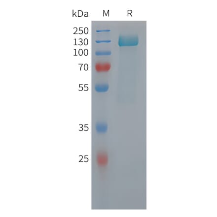 SDS-PAGE - Recombinant Human Tau Protein (6xHis Tag) (A325059) - Antibodies.com