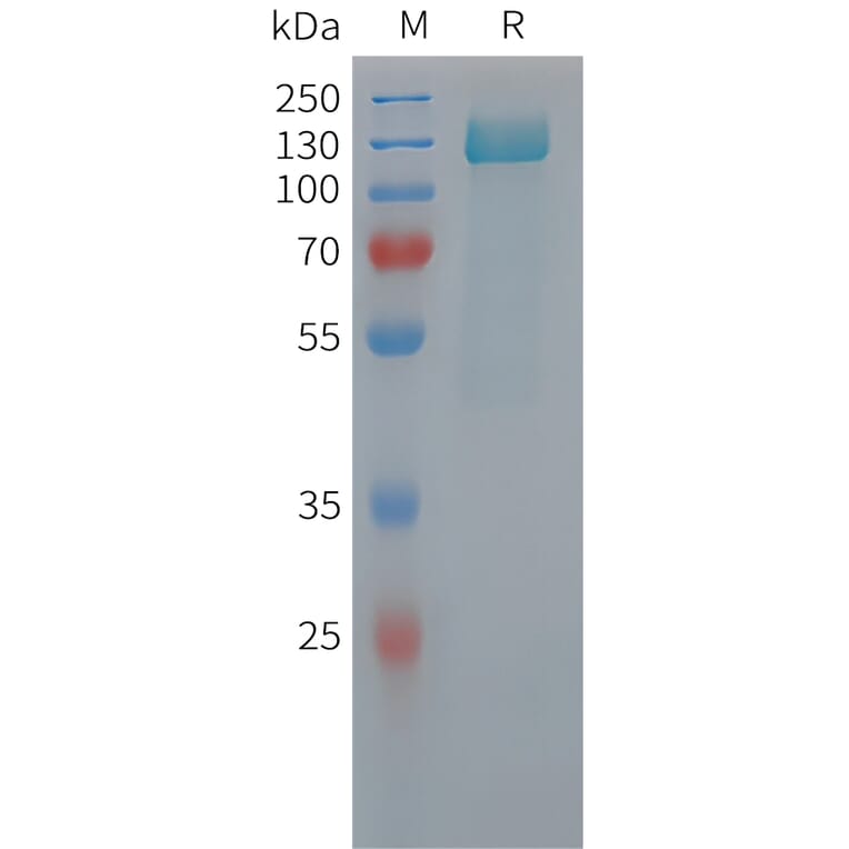SDS-PAGE - Recombinant Human Tau Protein (6xHis Tag) (A325059) - Antibodies.com