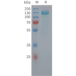 SDS-PAGE - Recombinant Human Tau Protein (6xHis Tag) (A325059) - Antibodies.com