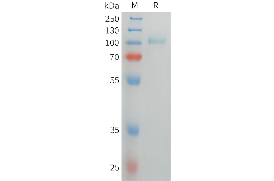 SDS-PAGE - Recombinant Human Thyroid Peroxidase/TPO Protein (6xHis Tag) (A325060) - Antibodies.com