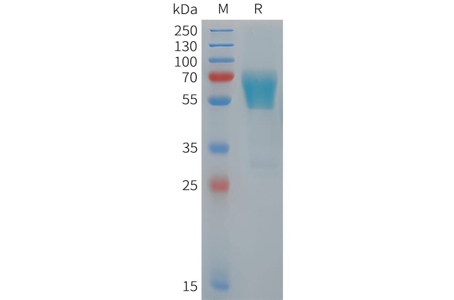 SDS-PAGE - Recombinant Human TIM 3 Protein (Fc Tag) (A325061) - Antibodies.com