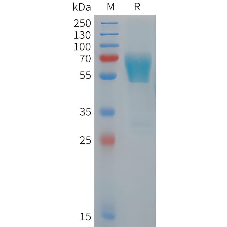 SDS-PAGE - Recombinant Human TIM 3 Protein (Fc Tag) (A325061) - Antibodies.com