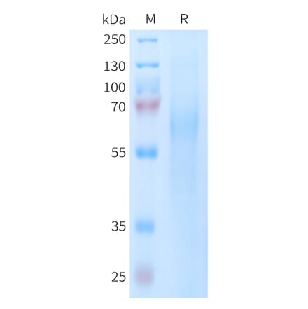 SDS-PAGE - Recombinant Human TIM 4 Protein (6xHis Tag) (A325062) - Antibodies.com