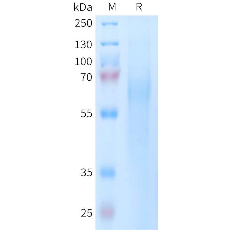 SDS-PAGE - Recombinant Human TIM 4 Protein (6xHis Tag) (A325062) - Antibodies.com