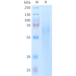 SDS-PAGE - Recombinant Human TIM 4 Protein (6xHis Tag) (A325062) - Antibodies.com