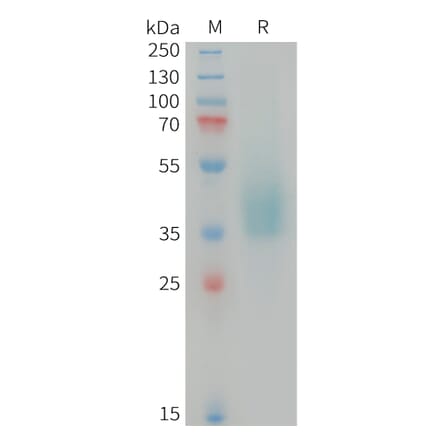SDS-PAGE - Recombinant Human Tissue Kallikrein Protein (6xHis Tag) (A325063) - Antibodies.com