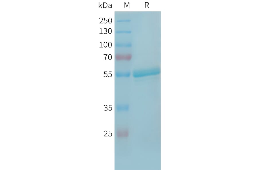 SDS-PAGE - Recombinant Human TLT-1 Protein (Fc Tag) (A325064) - Antibodies.com