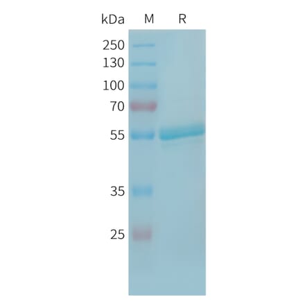 SDS-PAGE - Recombinant Human TLT-1 Protein (Fc Tag) (A325064) - Antibodies.com