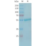 SDS-PAGE - Recombinant Human TLT-1 Protein (Fc Tag) (A325064) - Antibodies.com