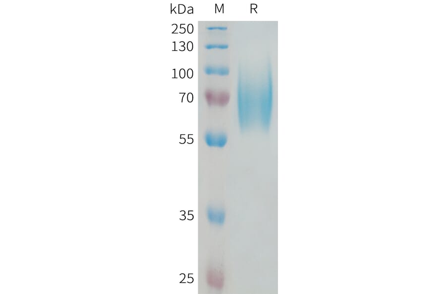 SDS-PAGE - Recombinant Human TrkB Protein (6xHis Tag) (A325065) - Antibodies.com