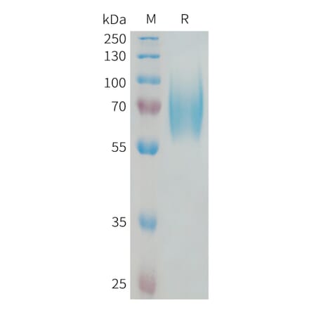 SDS-PAGE - Recombinant Human TrkB Protein (6xHis Tag) (A325065) - Antibodies.com