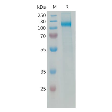SDS-PAGE - Recombinant Human VAP1 Protein (6xHis Tag) (A325066) - Antibodies.com