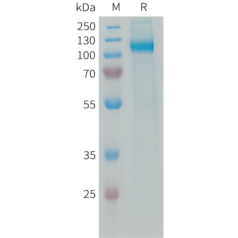 SDS-PAGE - Recombinant Human VAP1 Protein (6xHis Tag) (A325066) - Antibodies.com