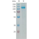 SDS-PAGE - Recombinant Human VAP1 Protein (6xHis Tag) (A325066) - Antibodies.com
