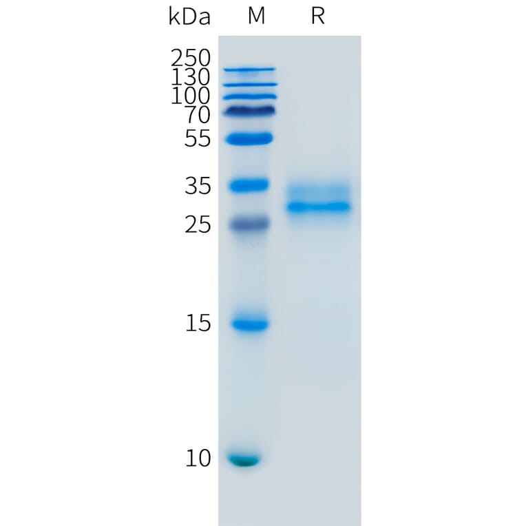 SDS-PAGE - Recombinant Mouse Folate Binding Protein/FBP Protein (10xHis Tag) (A325068) - Antibodies.com