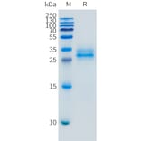 SDS-PAGE - Recombinant Mouse Folate Binding Protein/FBP Protein (10xHis Tag) (A325068) - Antibodies.com