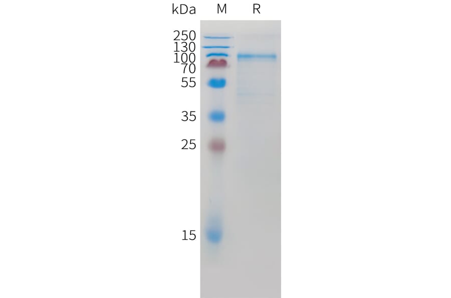 SDS-PAGE - Recombinant Mouse K Cadherin/CDH6 Protein (10xHis Tag) (A325069) - Antibodies.com