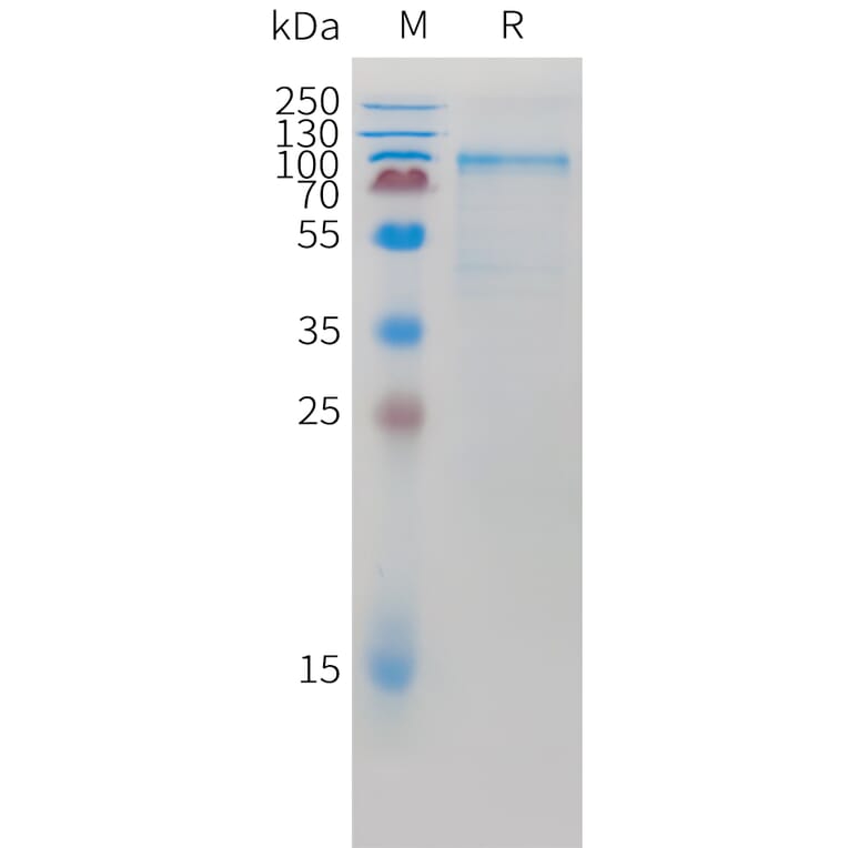 SDS-PAGE - Recombinant Mouse K Cadherin/CDH6 Protein (10xHis Tag) (A325069) - Antibodies.com