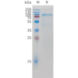 SDS-PAGE - Recombinant Mouse K Cadherin/CDH6 Protein (10xHis Tag) (A325069) - Antibodies.com