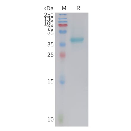 SDS-PAGE - Recombinant Mouse Nectin-4 Protein (10xHis Tag) (A325070) - Antibodies.com