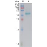 SDS-PAGE - Recombinant Mouse Nectin-4 Protein (10xHis Tag) (A325070) - Antibodies.com