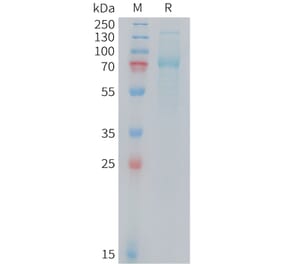 SDS-PAGE - Recombinant Mouse Transferrin Receptor Protein (10xHis Tag) (A325071) - Antibodies.com