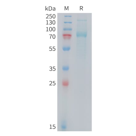 SDS-PAGE - Recombinant Mouse Transferrin Receptor Protein (10xHis Tag) (A325071) - Antibodies.com